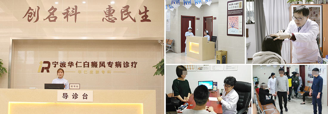 寧波白癜風醫院